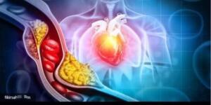 K’otü kolesterolü sıfırlıyor! Suya bekleyip tane tane yiyin, tıkalı damarları hortum gibi açıyor.