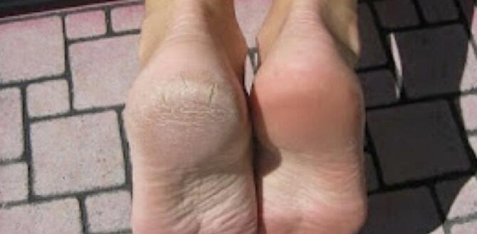 Topuk Çatlaklarınıza Doğal Çözüm T’arifi