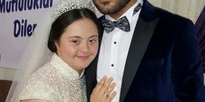 D’own sendromlu güzel bir kızla evlendim ilk gecemizde bunu istedi..